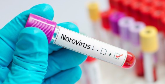 Роспотребнадзор: Источник норовирусной инфекции в Певеке обнаружен